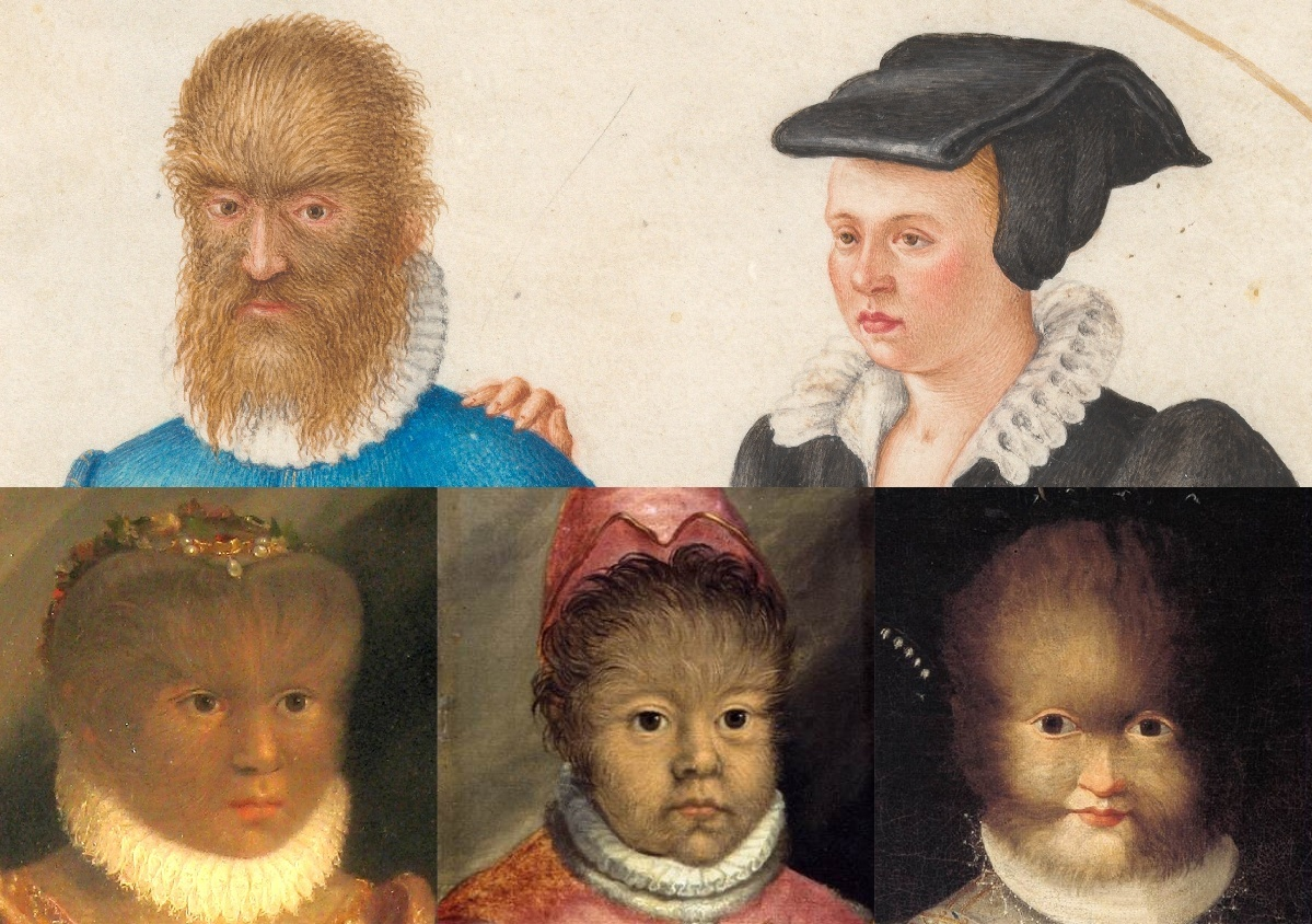 20250816-Cell-陈婷-1.世界上首次有记录的先天性全身多毛症患者Petrus Gonsalvus(1537-1618)及其妻子(上排)和子女(下排)。.png